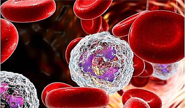 11 důvodů pro zvýšení neutrofilů v krvi dítěte