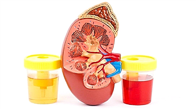 16 huvudorsaker till att röda blodkroppar uppträder i barnets urin