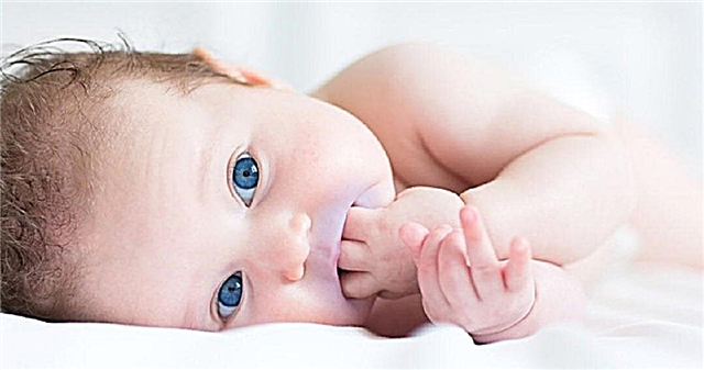 3 gruppi di cause di cianosi del triangolo naso-labiale nei neonati