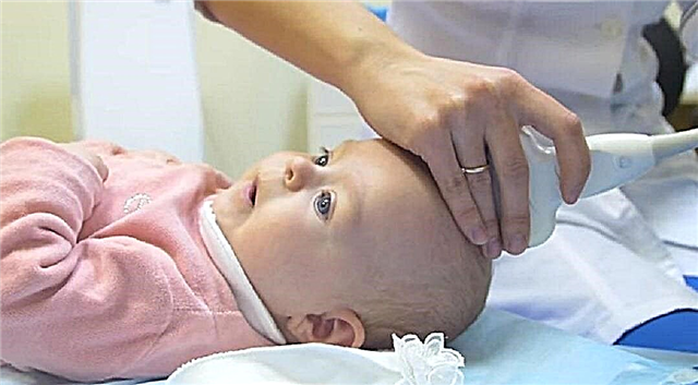 6 indicazioni per la neurosonografia neonatale