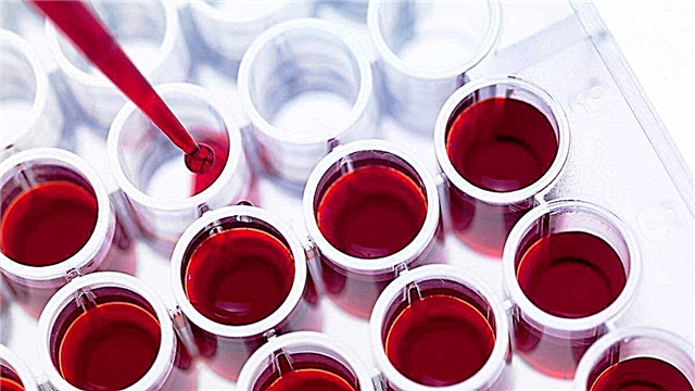 Taxa de ESR no sangue de crianças: o que mostra e como é determinado