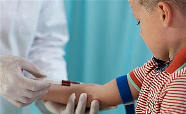 7 razones principales del aumento de linfocitos en la sangre de un niño