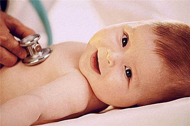 8 häufige Symptome, die auf eine angeborene Hypothyreose bei einem Säugling hinweisen