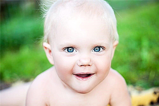 „Biała kruk”, czyli cechy zdrowia i rozwoju dziecka albinosa