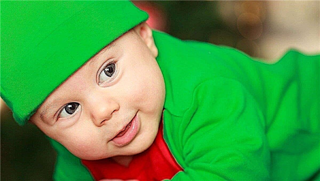 What are elf-faced children, and why does Williams syndrome occur in toddlers?