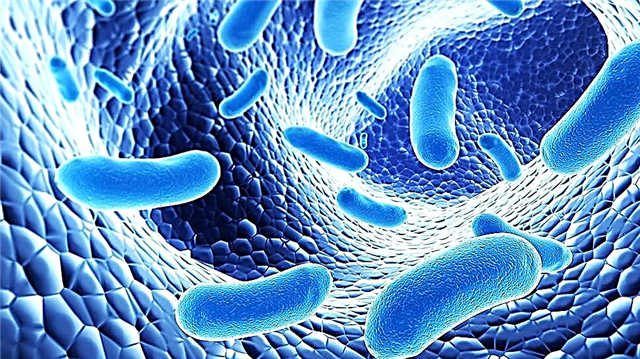 Dysbacteriosis - a disease or a Russian invention? The practitioner tells the most relevant information about this condition in children