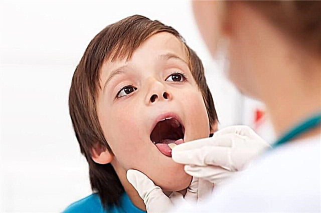 A practicing pediatrician talks about how to cure a child's throat infection at home