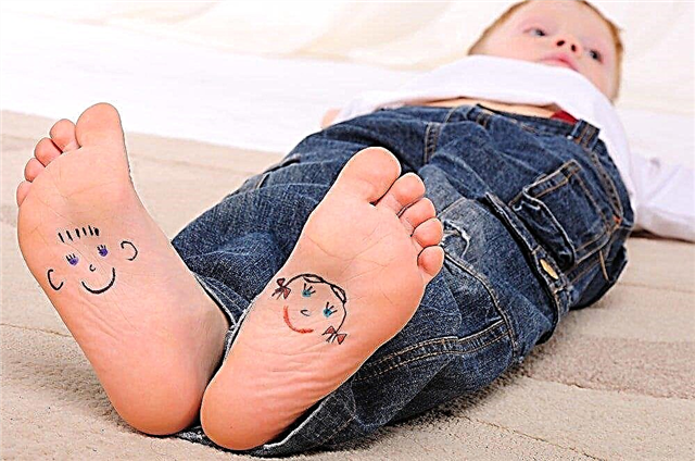 Plokščios pėdos kūdikiui: diagnozė ar sakinys?