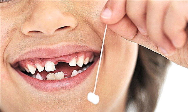 Odpoveď lekára na otázku rodičov: „Kedy deťom vypadnú mliečne zuby?“