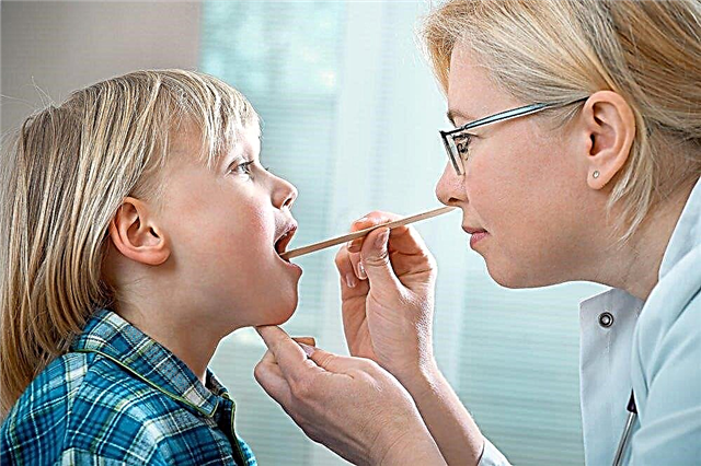 Чому небезпечна інфекція носоглотки у дитини? Про симптоми ревматизму у дітей розповідає досвідчений педіатр