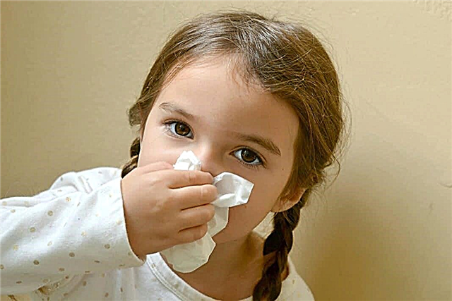Bagaimana cara cepat menyembuhkan sinusitis pada anak dan menghindari komplikasi? Saran dokter anak