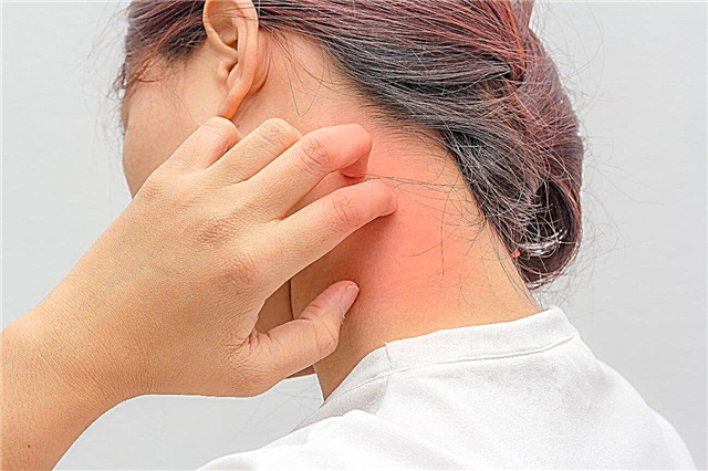 Enfermedad del suero, o lo que los padres de niños con alergias deben saber sobre la administración de sueros