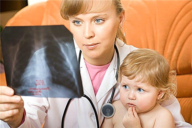 3 tilnærminger til klassifisering og de viktigste tegn på lungebetennelse hos barn