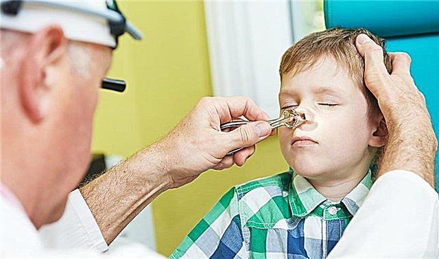 7 gejala utama yang berbicara tentang sinusitis pada anak