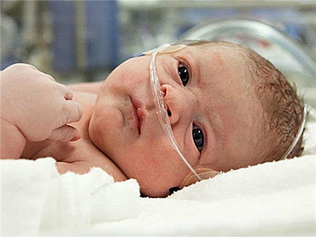 O que é asfixia do recém-nascido: causas pulmonares e extrapulmonares de desenvolvimento, táticas médicas