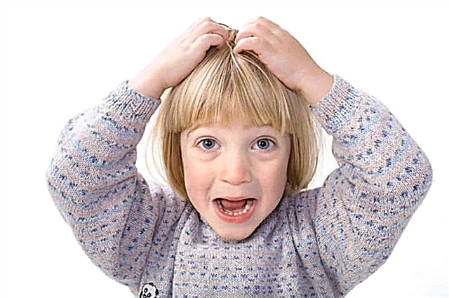 Apa yang harus dilakukan jika anak Anda memiliki kutu rambut: pedikulosis pada anak-anak dan 13 pengobatan untuk menghilangkannya