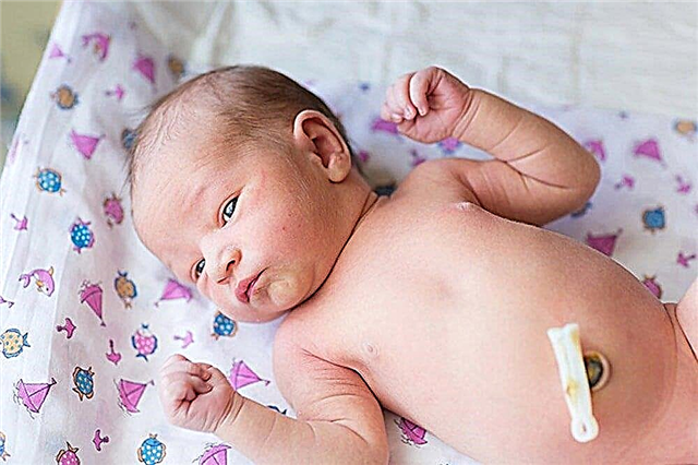 How to suspect omphalitis in a newborn?