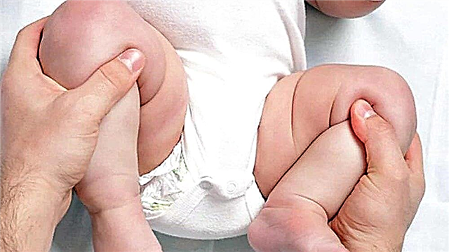 Mida peate teadma beebi puusaliigese düsplaasia ja selle ravi kohta?