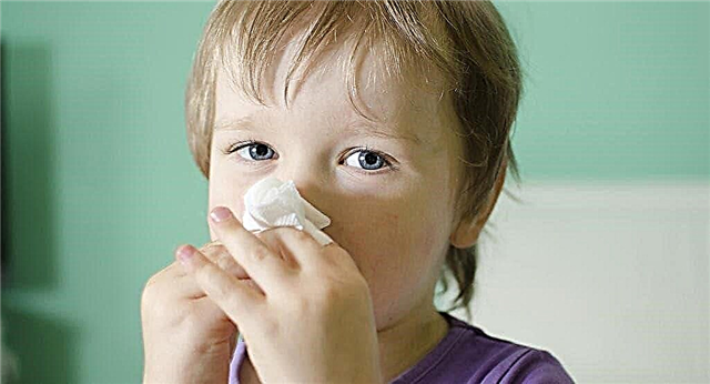 Hoe een allergische hoest bij een kind op tijd herkennen en genezen?
