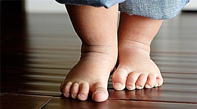 4 grupos de razões que explicam por que uma criança anda na ponta dos pés