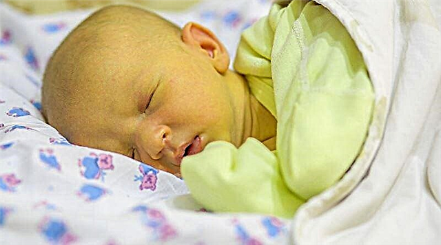 Dlaczego nie należy ignorować żółtaczki u noworodków?