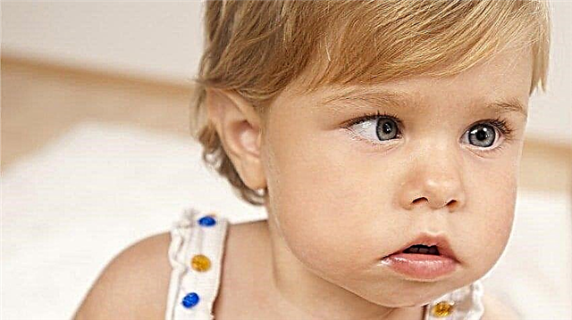 Bir çocukta şaşılık nasıl belirlenir? Pediatrik oftalmolog tavsiyesi