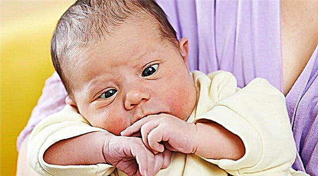 Strabismus pada bayi baru lahir - patologi atau norma?