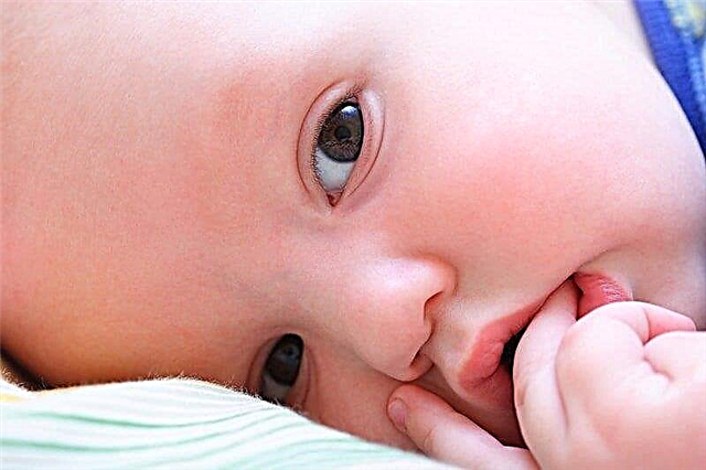 10 võimalust ravida soor (kandidoos) imiku keeles