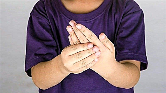 Kinderarts over juveniele reumatoïde artritis bij kinderen