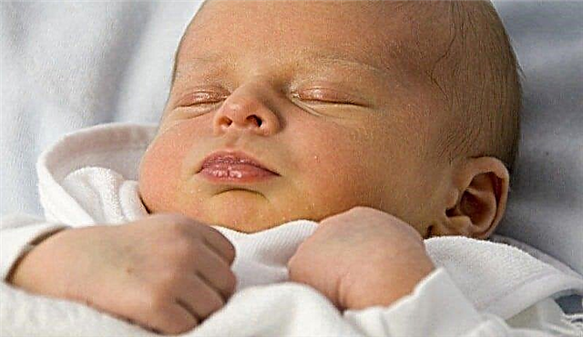 Mluvení o žloutence u novorozenců s pediatrem nejvyšší kategorie