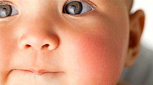 Os olhos de uma criança recém-nascida apodrecem - um algoritmo para solucionar o problema de um oftalmologista
