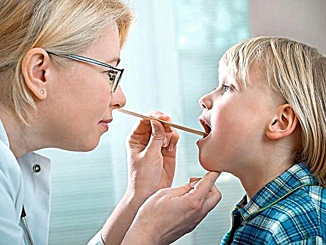 Behandling av herpes stomatitt hos et barn