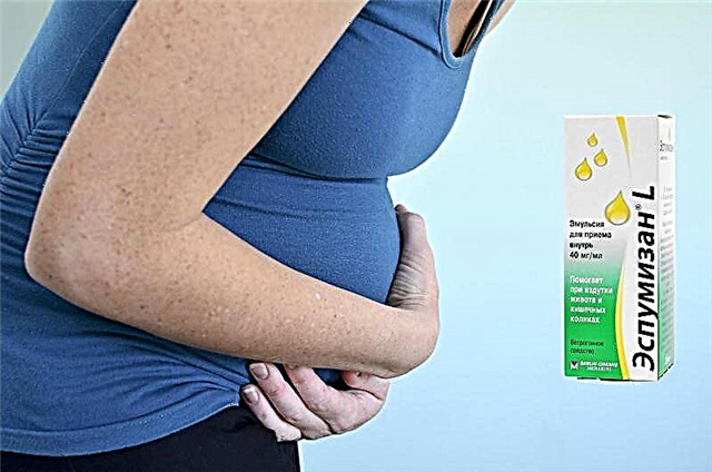  „Espumisan” w czasie ciąży: instrukcje użytkowania