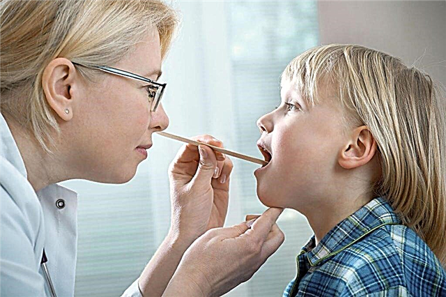 Географічний язик у дитини: від причин до лікування