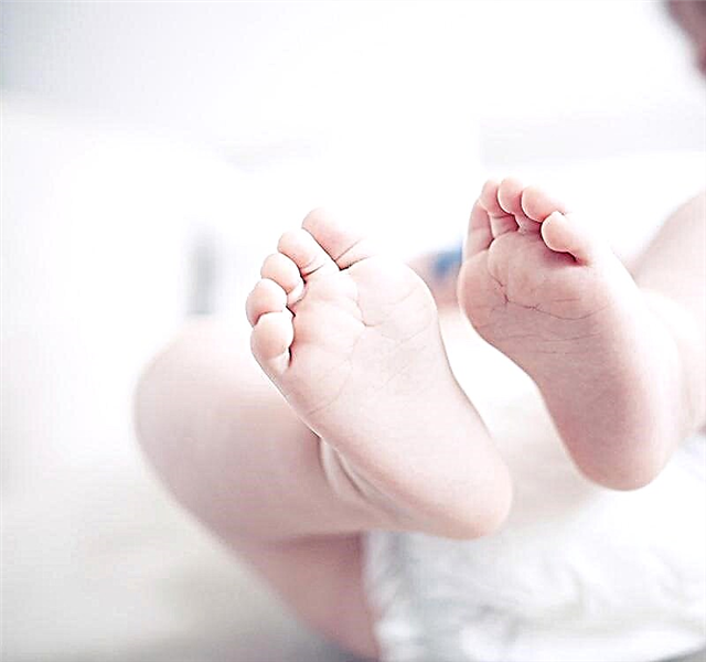 Tør hud på et barns hænder og fødder