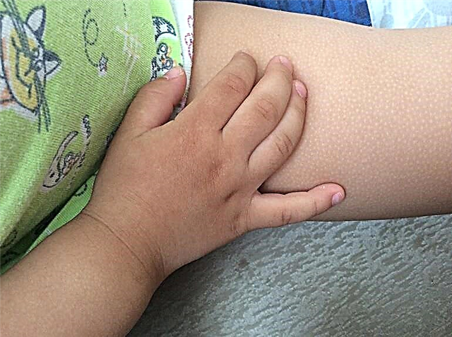 Proč má dítě husí kůži?