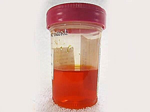 Rode urine bij een kind