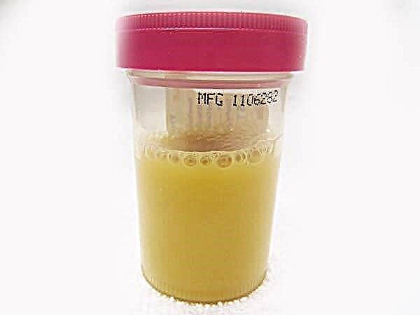 Flocos brancos na urina de uma criança