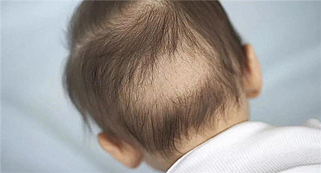 赤ちゃんの脱毛：原因とその排除
