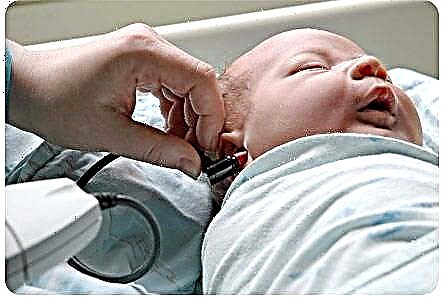 Ultra-som em 1 mês: primeira triagem de um recém-nascido