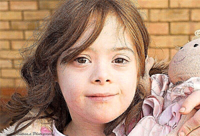 Children with Down syndrome: causes and signs, possible level of education