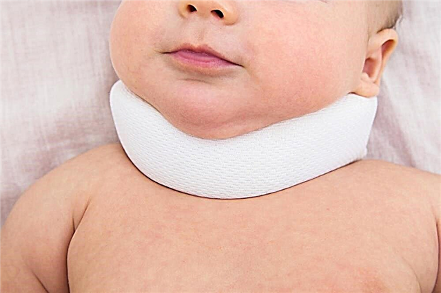 علامات وأعراض الصعر عند الأطفال حديثي الولادة والرضع