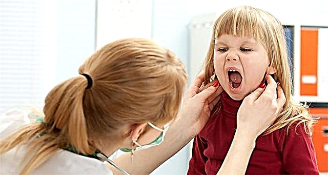Virus Epstein-Barr chez les enfants: tout, des symptômes au traitement