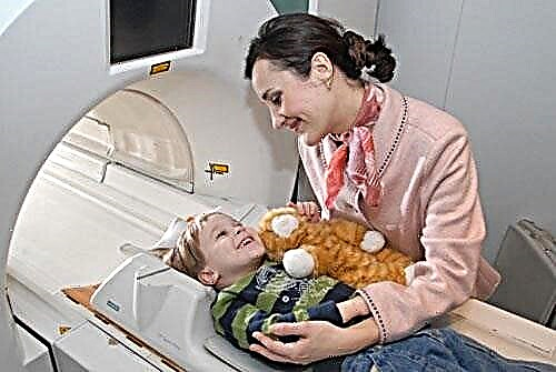 TC (tomografia computerizzata) del cervello del bambino