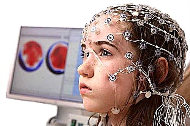 Was ist ein Gehirn-Enzephalogramm und warum wird es für Kinder durchgeführt?