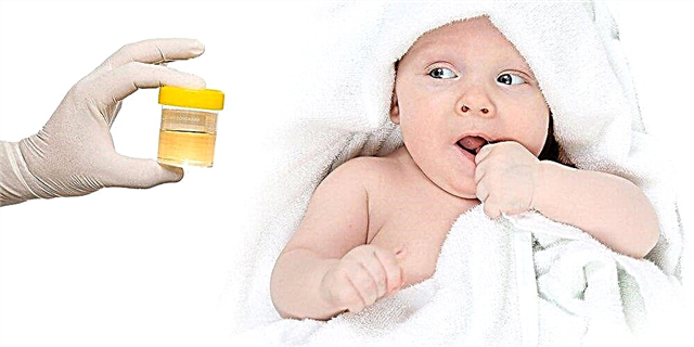 Askorbinska kislina v urinu otroka