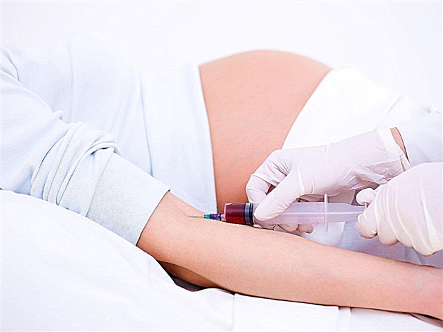 Que faire avec une augmentation du fibrinogène pendant la grossesse?