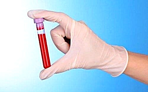 WBC blood test in children