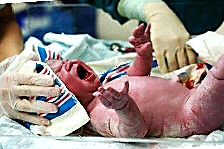 Asfiksia bayi baru lahir: dari sebab hingga akibat
