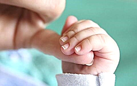 Hogyan kell helyesen levágni a körmöket az újszülöttek számára?